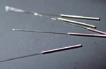 Acupuncture
